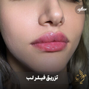 کلینیک پوست مو و زیبایی پارسامهر شیراز