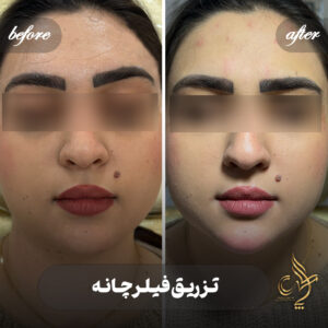 کلینیک پوست مو و زیبایی پارسامهر شیراز