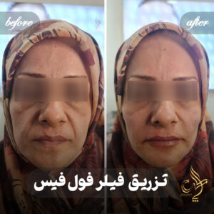 کلینیک پوست مو و زیبایی پارسامهر شیراز