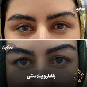 کلینیک پوست مو و زیبایی پارسامهر شیراز