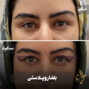کلینیک پوست مو و زیبایی پارسامهر شیراز