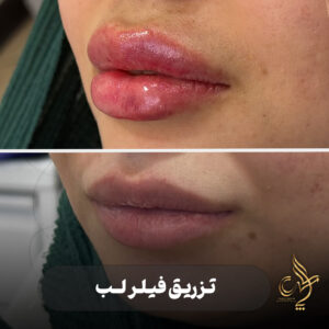 کلینیک پوست مو و زیبایی پارسامهر شیراز
