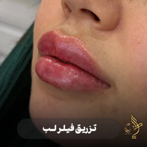 کلینیک پوست مو و زیبایی پارسامهر شیراز