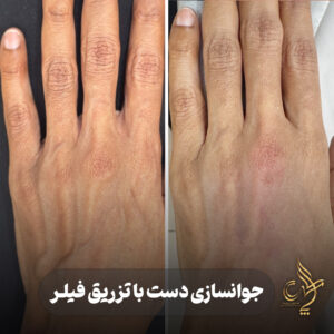 کلینیک پوست مو و زیبایی پارسامهر شیراز