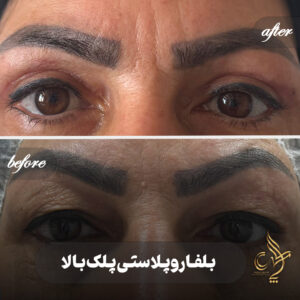 کلینیک پوست مو و زیبایی پارسامهر شیراز