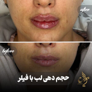 کلینیک پوست مو و زیبایی پارسامهر شیراز