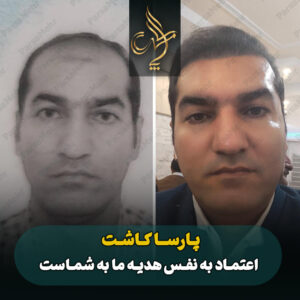 نمونه کار کاشت مو شیراز کلینیک پارسامهر