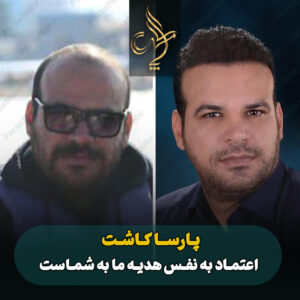 نمونه کار کاشت مو شیراز کلینیک پارسامهر