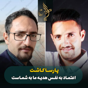 نمونه کار کاشت مو شیراز کلینیک پارسامهر