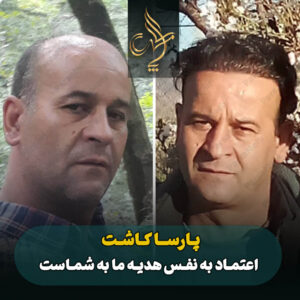 نمونه کار کاشت مو شیراز کلینیک پارسامهر