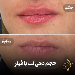 کلینیک پوست مو و زیبایی پارسامهر شیراز