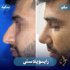 کلینیک پوست مو و زیبایی پارسامهر شیراز
