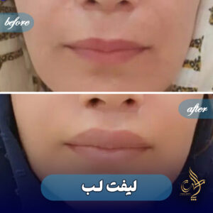 کلینیک پوست مو و زیبایی پارسامهر شیراز