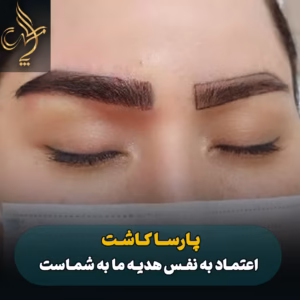 نمونه کار کاشت ابرو شیراز کلینیک پارسامهر