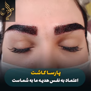 نمونه کار کاشت ابرو شیراز کلینیک پارسامهر